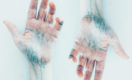 Добавки и витамини, които могат да помогнат при разширени вени